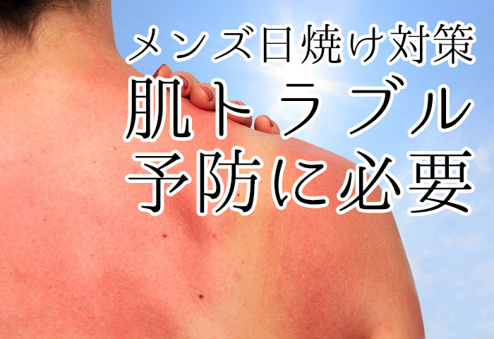 メンズの日焼け対策は様々な肌トラブルを予防するために必要